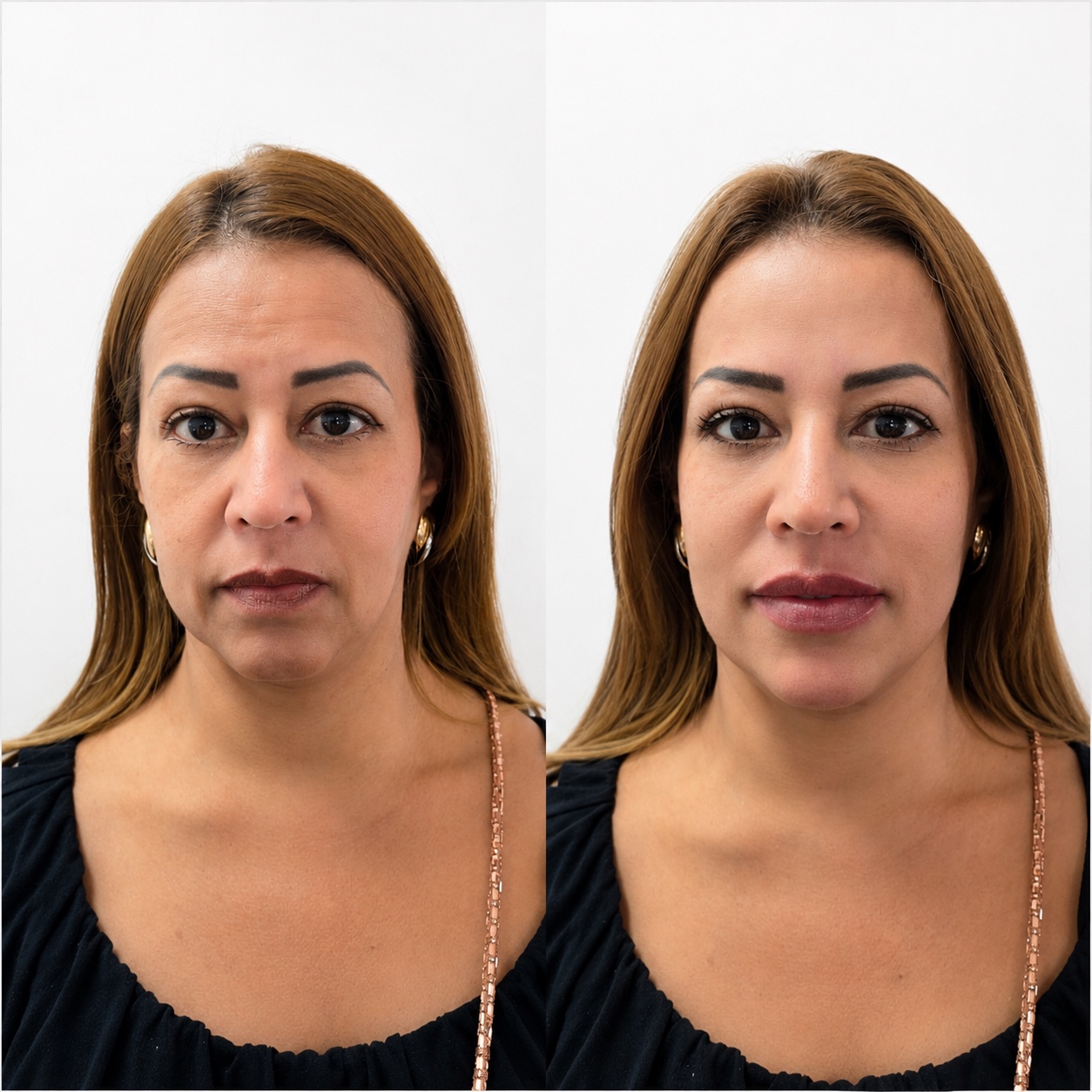 Antes e depois de gerenciamento facial